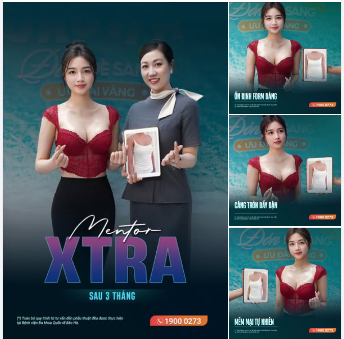 MENTOR XTRA – MỘT LỰA CHỌN ĐƯỢC NHIỀU CHỊ EM QUAN TÂM KHI NÂNG CẤP VÒNG 1