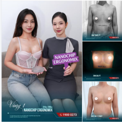 FEEDBACK THỰC TẾ – NANOCHIP ERGONOMIX