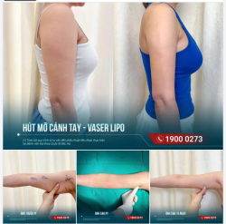 CÁNH TAY SAU 15 NGÀY – TÁI KHÁM VÀ NHÌN LẠI SỰ THAY ĐỔI