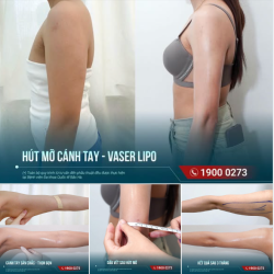 AI TỪNG NGHĨ HÚT MỠ CÁNH TAY CHỈ LÀM TAY NHỎ HƠN?