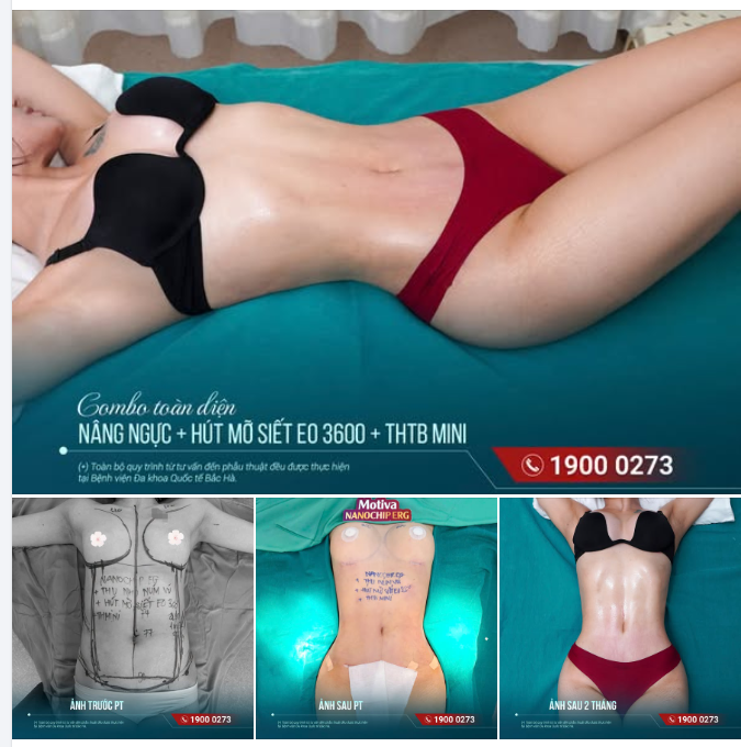 LẤY LẠI BODY CHO MẸ BỈM – THEO CÁCH TINH TẾ HƠN