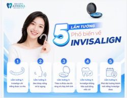 5 LẦM TƯỞNG VỀ INVISALIGN RẤT DỄ LÀM BẠN "RÚT LẠI Ý ĐỊNH" NIỀNG RĂNG