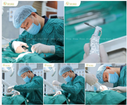 Trồng Implant – Vững tay nghề, trọn niềm tin tại Viet Smile
