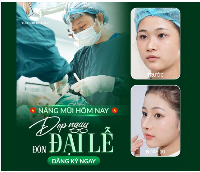 "Độ" dáng mũi đẹp đón Đại Lễ