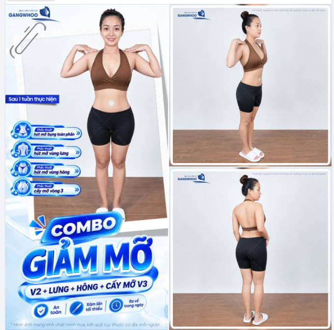 THĂNG HẠNG VÓC DÁNG SAU THỰC HIỆN COMBO GIẢM MỠ