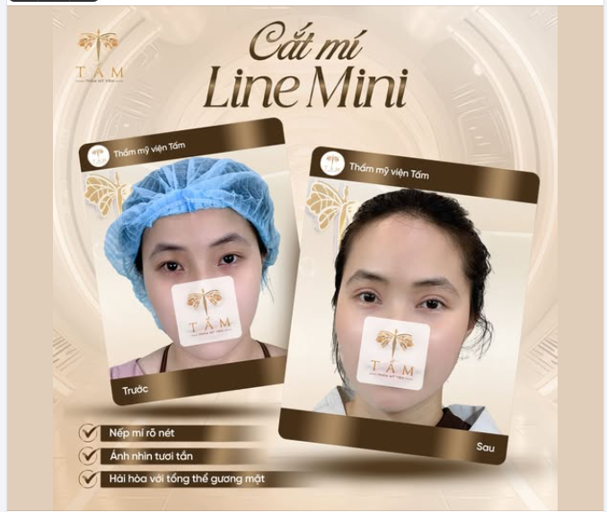 CẮT MÍ LINE MINI – THIẾT KẾ NẾP MÍ PHÙ HỢP TỪNG DÁNG MẮT