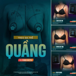 Hình ảnh sau phẫu thuật cho thấy bầu ngực đã gọn gàng, cân đối hơn nhưng vẫn giữ được sự hài hòa tự nhiên.