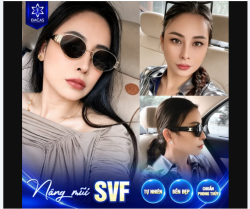 NÂNG MŨI SVF – ĐẸP HÀI HÒA TỪ MỌI GÓC NHÌN