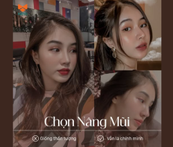Đừng chọn nâng mũi chỉ vì bạn thấy kết quả đẹp trên một người khác.