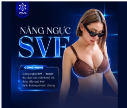 Feedback NÂNG NGỰC SVF SAU 2 NĂM