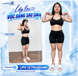 LẤY LẠI VÓC DÁNG SAU SINH