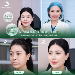 MESO NÂNG CƠ CELLBOOSTER LIFT – TĂNG SINH COLLAGEN, MANG LẠI LÀN DA CĂNG MỊN TƯƠI TRẺ!
