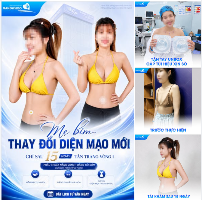 MẸ BỈM THAY ĐỔI DIỆN MẠO MỚI - CHỈ SAU 15 NGÀY TÂN TRANG VÒNG 1