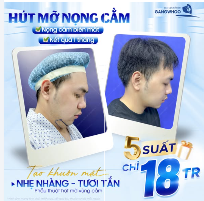 NỌNG CẰM GỌN – GƯƠNG MẶT THANH THOÁT HƠN