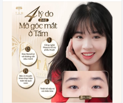 4 lý do nên mở góc mắt tại Thẩm mỹ viện Tấm