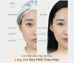 TRẺ HÓA ĐA TẦNG VỚI PRH TOÀN DIỆN