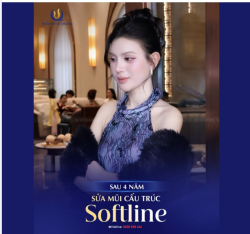 Mũi đẹp thôi chưa đủ — quan trọng là phải BỀN theo thời gian!