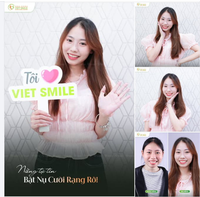 TƯƠI NHƯ NẮNG HẠ - HUYỀN TRANG TỰ TIN TỎA SÁNG SAU KHI THÁO NIỀNG TẠI VIET SMILE!