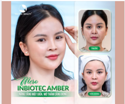 ĐÁNH THỨC LÀN DA CĂNG BÓNG VỚI MESO INBIOTEC AMBER
