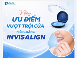 BẠN MUỐN RĂNG ĐẸP NHƯNG LẠI SỢ "LỘ MẮC CÀI"? INVISALIGN CHÍNH LÀ LỰA CHỌN DÀNH CHO BẠN!