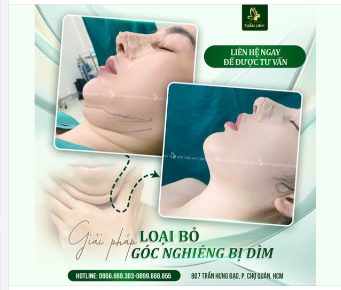 HÚT NỌNG CẰM – GIẢI PHÁP LOẠI BỎ GÓC NGHIÊNG BỊ DÌM