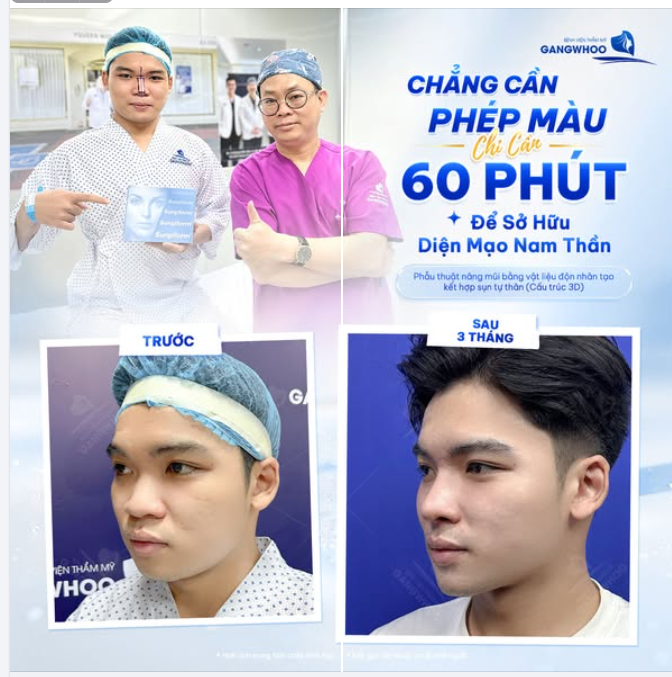 CHẲNG CẦN PHÉP MÀU CHỈ CẦN 60 PHÚT