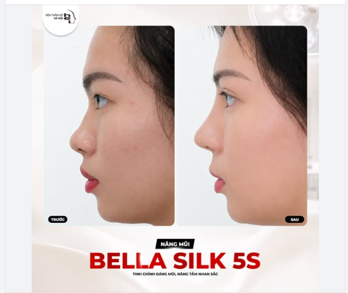 GÓC NGHIÊNG THẦN THÁNH CHỈ SAU 45 PHÚT VỚI BELLA SILK 5S