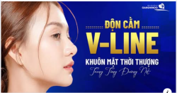 ĐỘN CẰM V-LINE – KIẾN TẠO GÓC NGHIÊNG THANH THOÁT, KHUÔN MẶT HÀI HÒA
