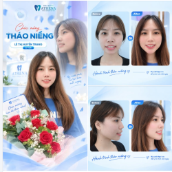 "27 TUỔI NIỀNG RĂNG CÓ MUỘN KHÔNG?" CÂU TRẢ LỜI NẰM NGAY TRÊN NỤ CƯỜI MỚI CỦA HUYỀN TRANG!