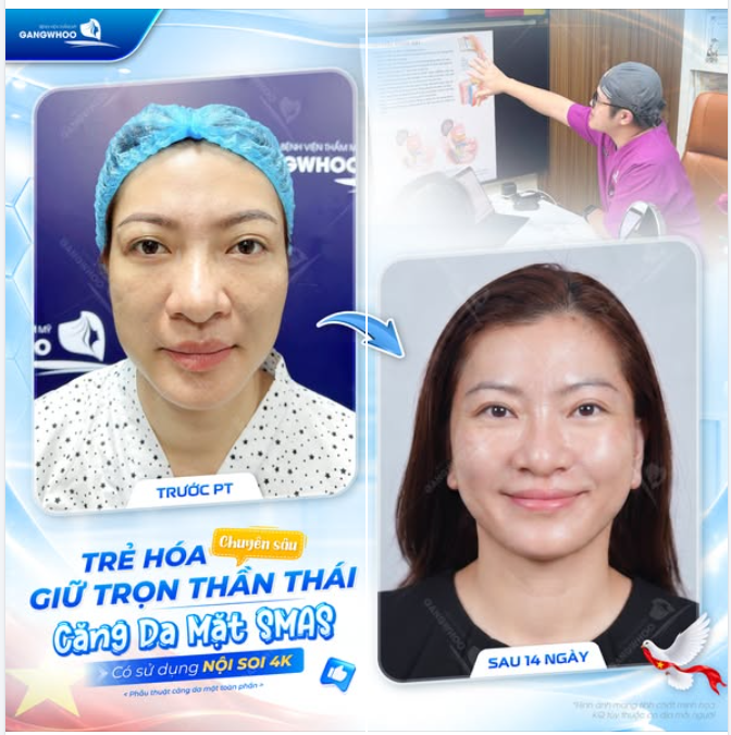 TRẺ HÓA CHUYÊN SÂU, GIỮ TRỌN THẦN THÁI