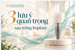 3 LƯU Ý QUAN TRỌNG SAU TRỒNG RĂNG IMPLANT