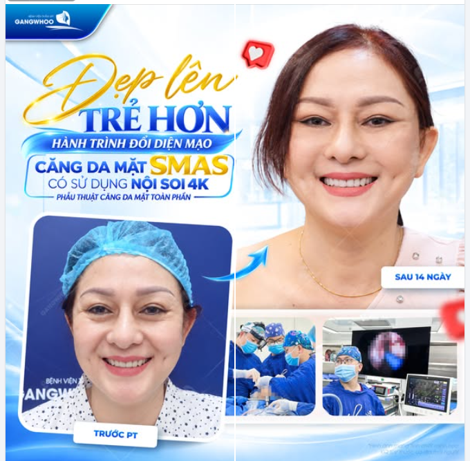 ĐẸP LÊN - TRẺ HƠN HÀNH TRÌNH ĐỔI DIỆN MẠO