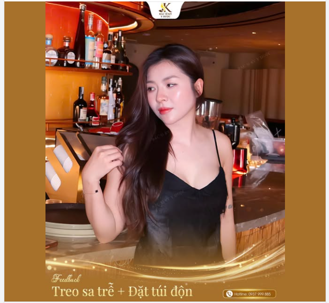 TREO SA TRỄ + ĐẶT TÚI ĐÔI – THAY ĐỔI VỪA ĐỦ, ĐẸP ĐÚNG DÁNG