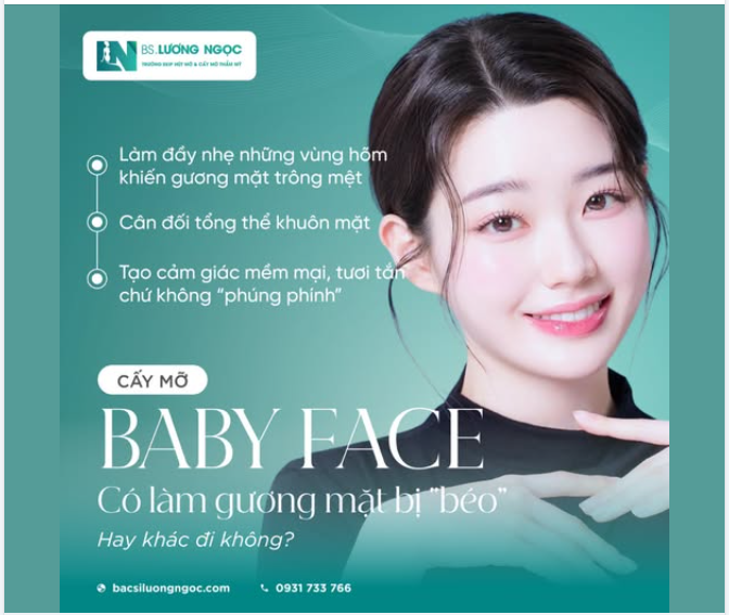 CẤY MỠ BABY FACE – KHI GƯƠNG MẶT ĐƯỢC “LÀM MỀM” ĐÚNG CÁCH