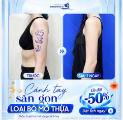 TỰ TIN DIỆN MỌI TRANG PHỤC VỚI CÁNH TAY SẮN GỌN