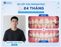 SỰ LỘT XÁC NGOẠN MỤC SAU 24 THÁNG: KHOẢN ĐẦU TƯ XỨNG ĐÁNG NHẤT CUỘC ĐỜI!
