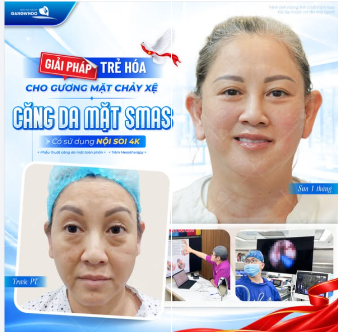 GIẢI PHÁP TRẺ HÓA CHO GƯƠNG MẶT CHẢY XỆ