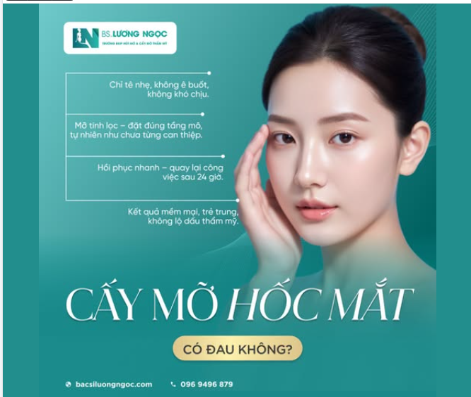 CẤY MỠ HỐC MẮT CÓ ĐAU KHÔNG? – ĐIỀU KHÁCH HÀNG NÊN BIẾT TRƯỚC KHI THỰC HIỆN