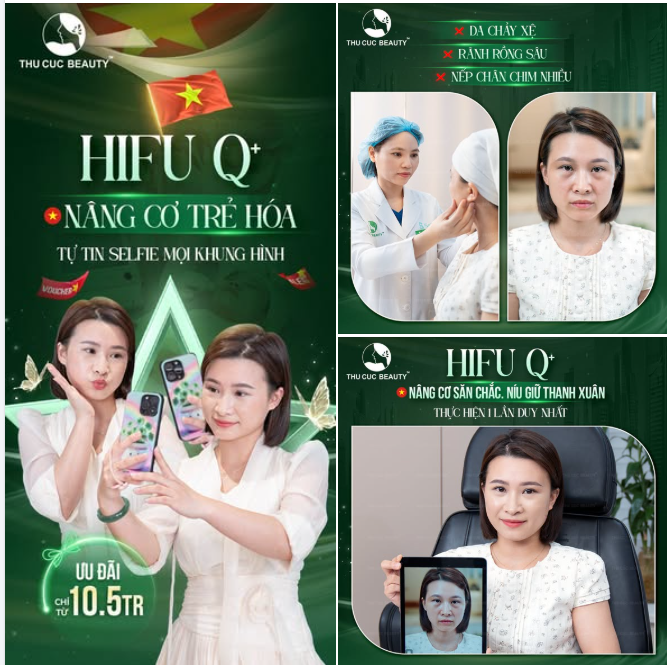 ĐẠI LỄ ĐẸP SANG - NÂNG CƠ SIẾT GỌN CHỈ SAU 1 LẦN VỚI HIFU Q+
