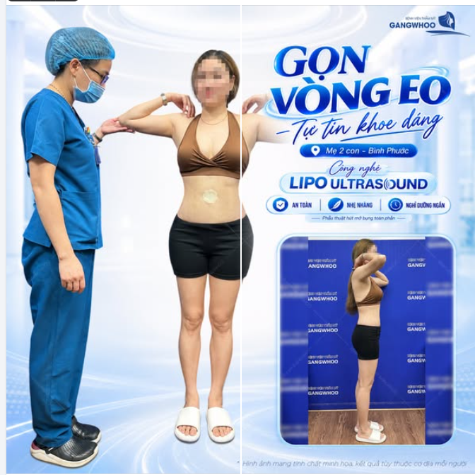 GỌN VÒNG EO – TỰ TIN KHOE DÁNG