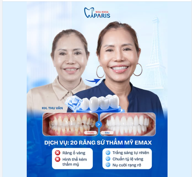 "HACK" NGAY 10 TUỔI NHỜ NÂNG CẤP NỤ CƯỜI RẠNG RỠ!