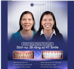 “TRẺ RA 10 TUỔI” NHỜ NỤ CƯỜI MỚI, ĂN NHAI CŨNG THOẢI MÁI HƠN!