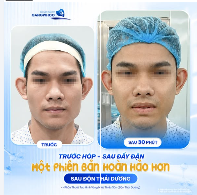 TRƯỚC HÓP - SAU ĐẦY ĐẶN
