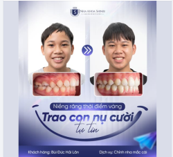 NIỀNG RĂNG ĐÚNG “THỜI ĐIỂM VÀNG” – MÓN QUÀ THEO CON ĐẾN TUỔI TRƯỞNG THÀNH.