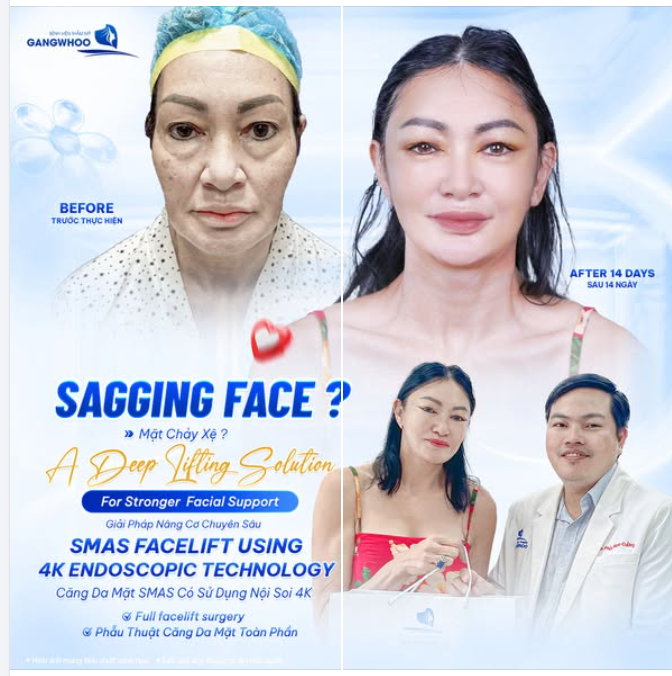 MẶT CHẢY XỆ? GIẢI PHÁP NÂNG CƠ CHUYÊN SÂU
