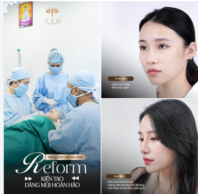 S-LINE TỰ NHIÊN HAY L-LINE? LỰA CHỌN NÀO MỚI LÀ "CHÂN ÁI"?