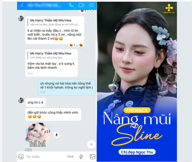 Đẹp tự nhiên đến mức người quen cũng khó nhận ra mình đã làm mũi.