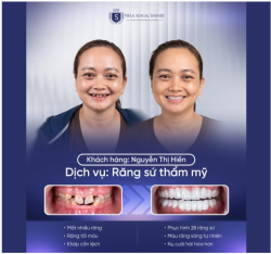 Mẹ cô dâu tậu răng xinh – Sẵn sàng cho đám cưới linh đình!