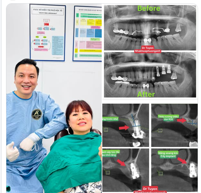 Để có được hình ảnh và trạng thái an toàn, happy nhất của BN sau mỗi ca phẫu thuật.
