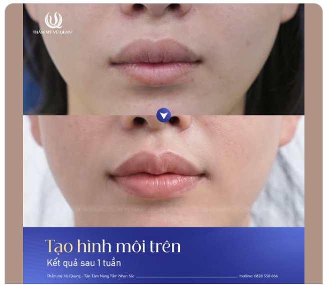 TẠO HÌNH ĐÔI MÔI MỌNG QUYẾN RŨ CHỈ 15 PHÚT!